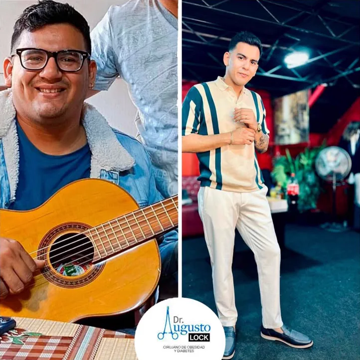 Sebastián Landa antes y después de su cirugía bariátrica