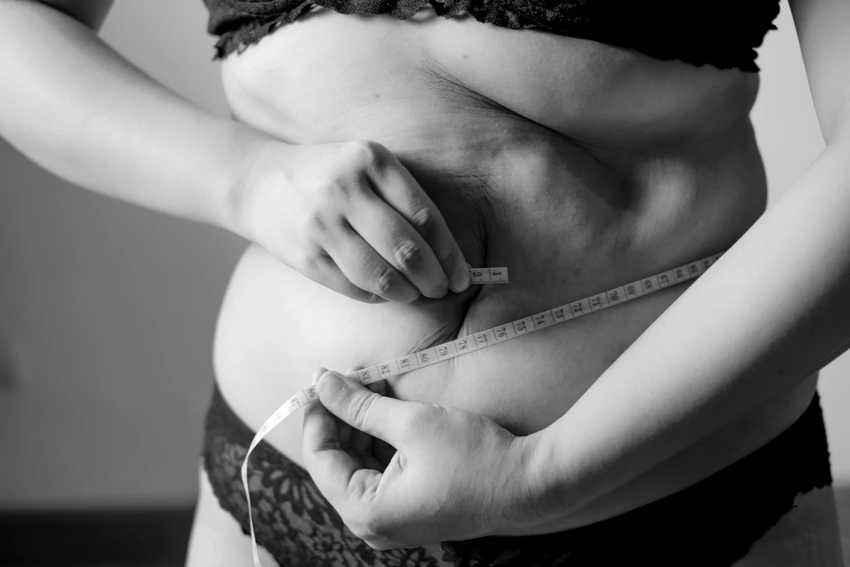 Abdomen medido con una cinta métrica