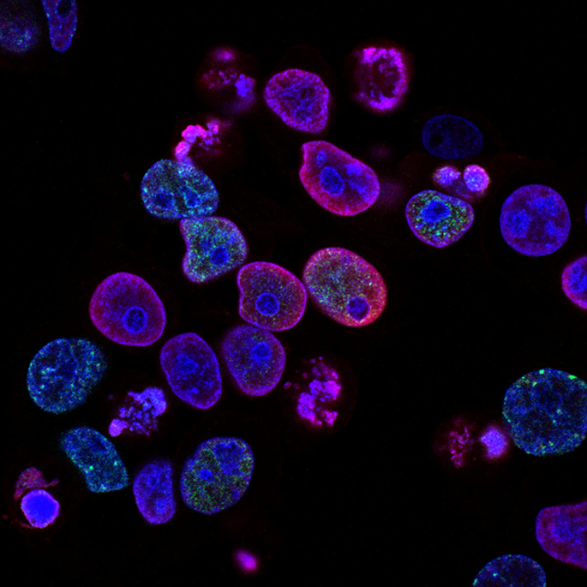Células observadas en microscopía de fluorescencia